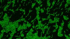 microscopic image of bacterial cells full of bright green cholestorol molecules