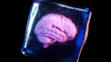 illustraion of a brain inside an icecube on a dark background